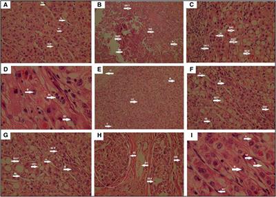 Development of Cholesterol-Lowering and Detox Formulations Using Bentonite and Herbal Ingredients